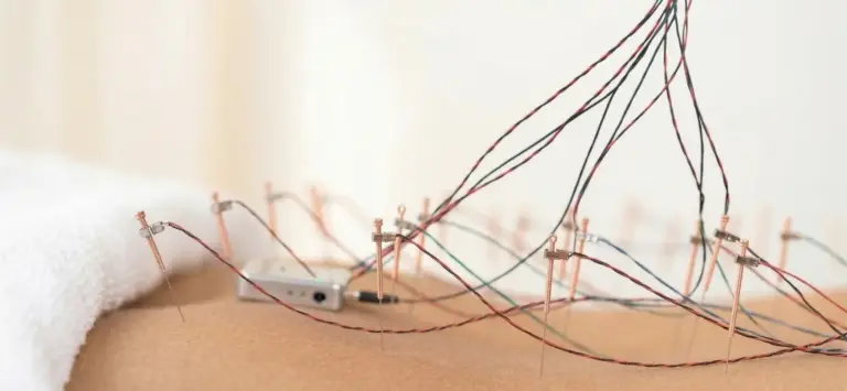 Elektro-Akupunktur Schönbühl