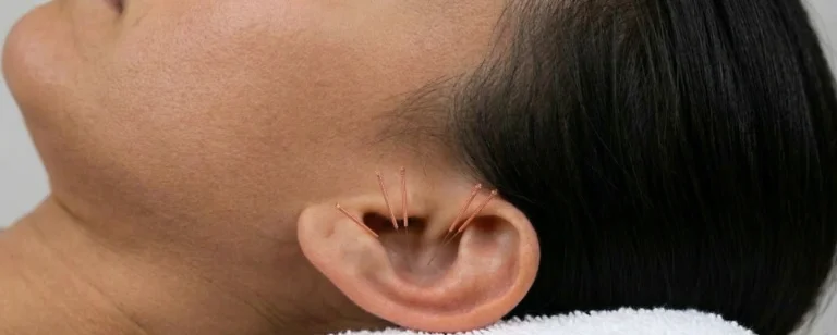 Ohr-Akupunktur Schönbühl