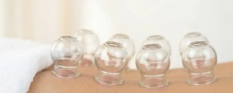 Schröpfen TCM Schönbühl